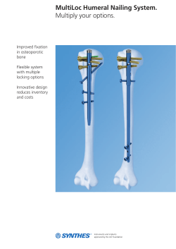 MultiLoc Humeral Nailing System. Multiply your options.
