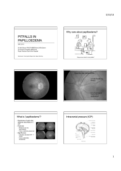3.3 - Monkey Software