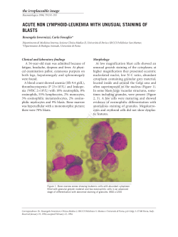 Acute non lymphoid-leukemia with unusual staining of blasts