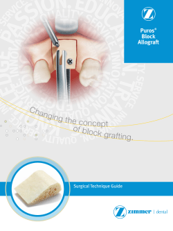 Puros Block Allograft Surgical Technique