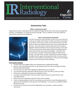 Gastrostomy Tube - Carilion Clinic