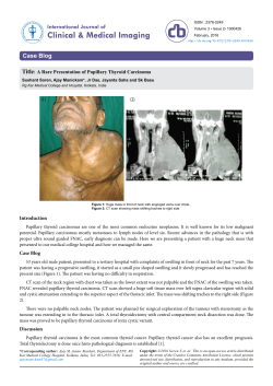 A Rare Presentation of Papillary Thyroid Carcinoma