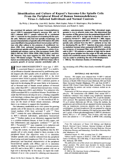 Identification and Culture of Kaposi`s Sarcoma