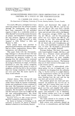 HYDRONEPHROSIS RESULTING FROM OBSTRUCTION OF THE
