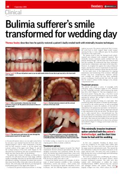 Bulimia sufferer`s smile transformed for wedding day