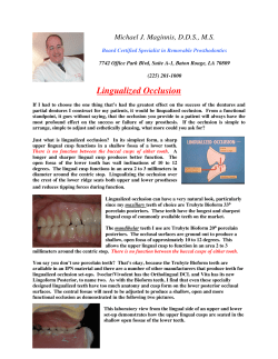 Lingualized Occlusion