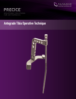 Antegrade Tibia Operative Technique
