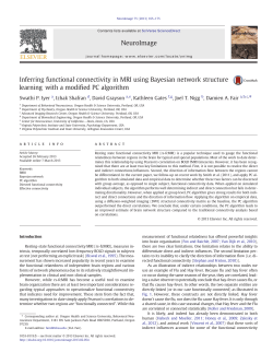 Inferring functional connectivity in MRI using Bayesian network