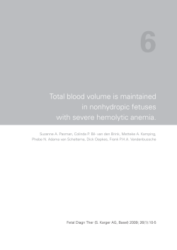 Total blood volume is maintained in nonhydropic fetuses with severe