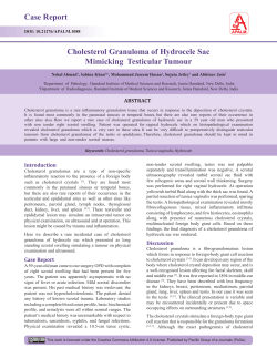 Case Report Cholesterol Granuloma of Hydrocele Sac Mimicking