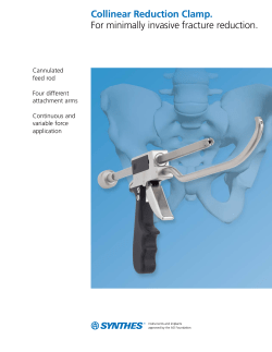 Collinear Reduction Clamp. For minimally invasive fracture reduction.