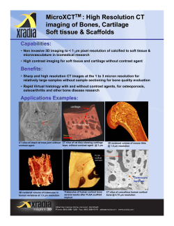 High Resolution CT imaging of Bones, Cartilage Soft