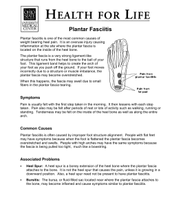 Plantar Fasciitis - OSU Patient Education Materials