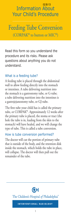 Feeding Tube Conversion