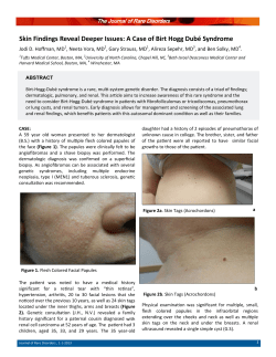 Skin Findings Reveal Deeper Issues: A Case of Birt Hogg Dub&eacute;