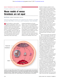 Mouse models of venous thrombosis are not equal