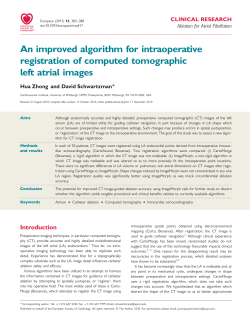 An improved algorithm for intraoperative registration of computed