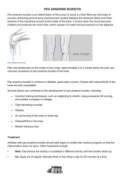 pes anserine bursitis - Beauchamp House Surgery