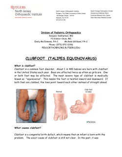 Clubfoot - Rutgers New Jersey Medical School