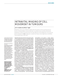 intravital imaging of cell movement in tumours
