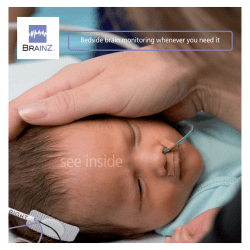 Bedside brain monitoring whenever you need it