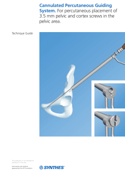Cannulated Percutaneous Guiding System. For percutaneous