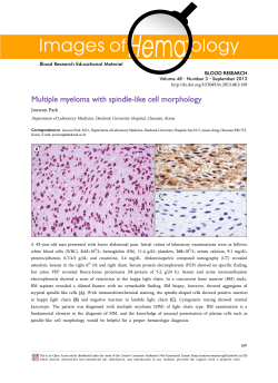 Multiple myeloma with spindle-like cell morphology