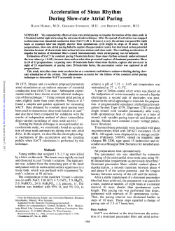 Acceleration of Sinus Rhythm