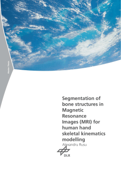 Segmentation of bone structures in Magnetic