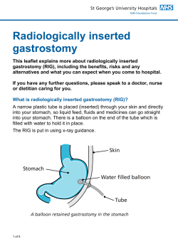 Radiologically inserted gastrostomy