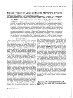 M.J. Hope, K.F. Wong and P.R. Cullis. Freeze