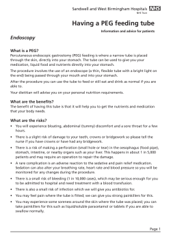 Having a PEG feeding tube - Sandwell and West Birmingham
