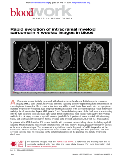 Rapid evolution of intracranial myeloid sarcoma in 4