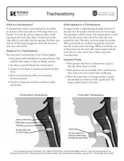 Tracheostomy