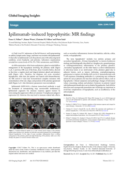 Ipilimumab-induced hypophysitis: MR findings