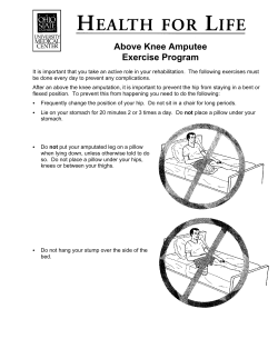 Above Knee Amputee Exercise Program