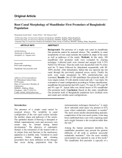 Original Article Root Canal Morphology of Mandibular First