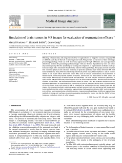 Simulation of brain tumors in MR images for evaluation of