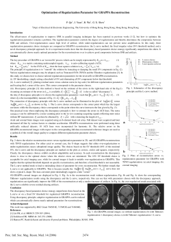 Optimization of Regularization Parameter for GRAPPA