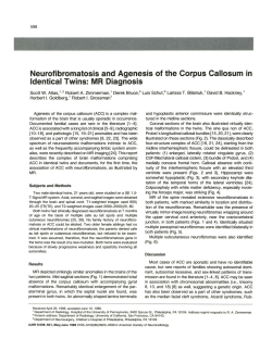 Neurofibromatosis and Agenesis of the Corpus Callosum in Identical