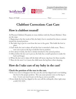 Clubfoot Correction - Phoenix Children`s Hospital