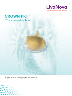 crown prttm