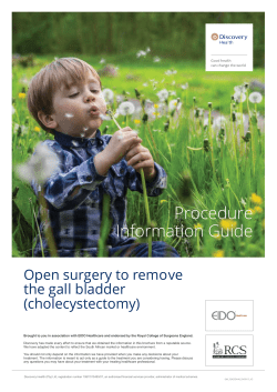 cholecystectomy