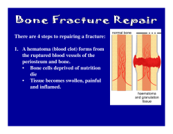 There are 4 steps to repairing a fracture: 1. A hematoma (blood clot