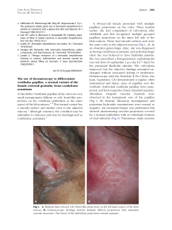 The use of dermatoscopy to differentiate vestibular papillae, a