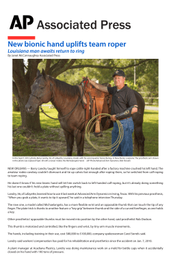 New bionic hand uplifts team roper
