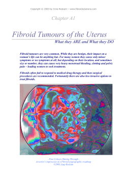 Fibroid Tumours of the Uterus