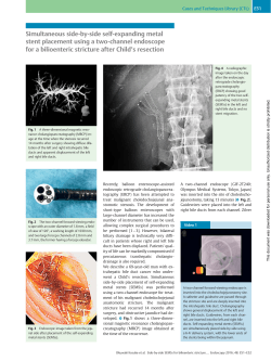 Simultaneous side-by-side self-expanding metal stent placement
