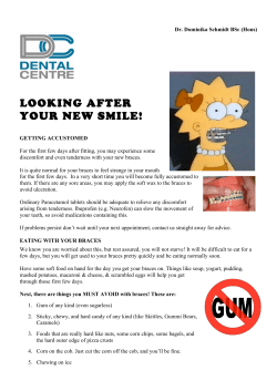 looking after your new smile!