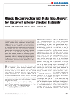 Glenoid Reconstruction With Distal Tibia Allograft